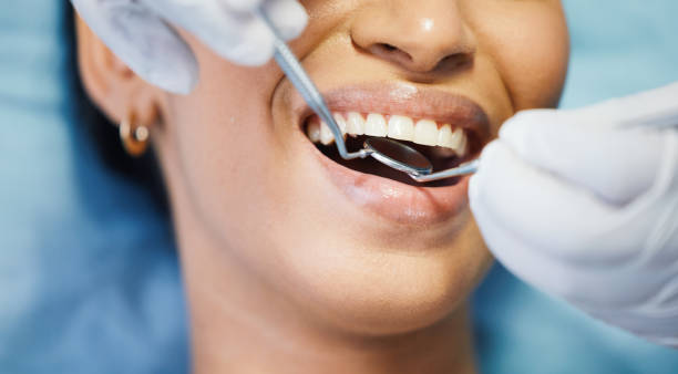 Best Emergency Dental Care for Broken or Chipped Teeth in Bloomer, WI
